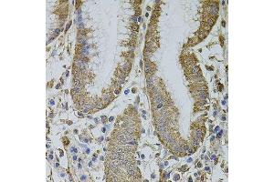 Immunohistochemistry of paraffin-embedded human stomach using MTIF3 antibody. (MTIF3 Antikörper  (AA 1-278))