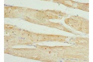 Immunohistochemistry of paraffin-embedded human skeletal muscle tissue using ABIN7173557 at dilution of 1:100 (Tropomodulin 4 Antikörper  (AA 1-345))