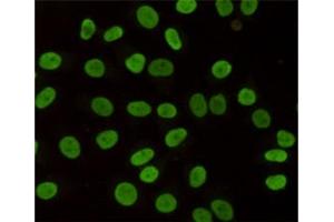 Immunocytochemistry staining of HeLa cells fixed with 4 % Paraformaldehyde and using anti-HP1-gamma mouse mAb (dilution 1:200). (CBX3 Antikörper)
