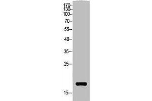 Western Blot analysis of AD-293 cells using Acetyl-NF-E4 (K43) Polyclonal Antibody (NFE4 Antikörper  (acLys43))