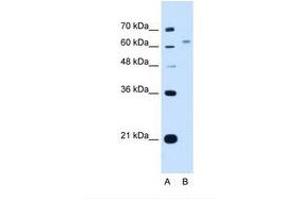 Image no. 1 for anti-WSC Domain Containing 2 (WSCD2) (C-Term) antibody (ABIN341313)