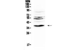 Western blot analysis of IL12B using anti-IL12B antibody . (IL12B Antikörper  (AA 23-250))
