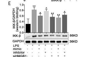 Effects of paeonol on IKK-β in LPS-induced RAW264. (GAPDH Antikörper)
