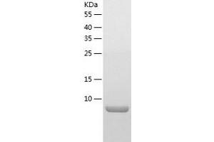 Oxidoreductase Like Domain Containing 1 (OXLD1) (AA 46-147) protein (His-IF2DI Tag)
