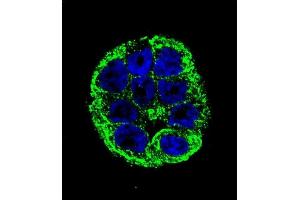 Confocal immunofluorescent analysis of YOD1 Antibody (C-term) (ABIN655251 and ABIN2844850) with WiDr cell followed by Alexa Fluor 488-conjugated goat anti-rabbit lgG (green). (YOD1 Antikörper  (C-Term))