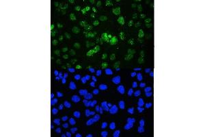 IF analysis of YY1 using anti-YY1 antibody (ABIN3044562).