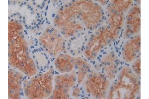 Immunohistochemistry (IHC) image for anti-Dipeptidyl-Peptidase 4 (DPP4) (AA 484-728) antibody (ABIN7432829)
