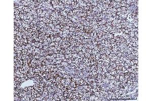 IHC analysis of GLUD1/2 using anti-GLUD1/2 antibody (ABIN7602000). (GLUD1 / GLUD2 (AA 54-553) Antikörper)