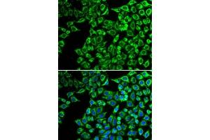 Immunofluorescence analysis of  cells using LIPC antibody (ABIN6131783, ABIN6143250, ABIN6143251 and ABIN6217533). (LIPC Antikörper  (AA 280-499))