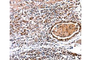 Immunohistochemistry (IHC) image for anti-DNA (Cytosine-5-)-Methyltransferase 3 alpha (DNMT3A) antibody (ABIN1872325) (DNMT3A Antikörper)