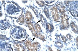 Human kidney; FOXF1 antibody - C-terminal region in Human kidney cells using Immunohistochemistry