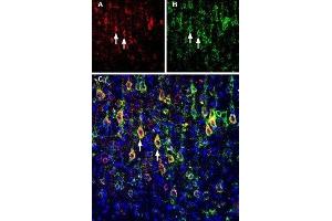 Multiplex staining of Slitrk1 and KV2. (SLIT and NTRK-Like Family, Member 1 (SLITRK1) Peptid)
