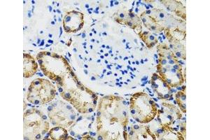 Immunohistochemistry of paraffin-embedded Mouse kidney using COMT Polyclonal Antibody at dilution of 1:100 (40x lens). (COMT Antikörper)