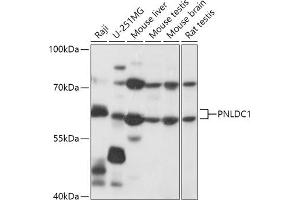 Western blot analysis of extracts of various cell lines, using PNLDC1 antibody (ABIN7269447) at 1:1000 dilution. (PNLDC1 Antikörper  (AA 200-500))