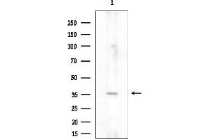 anti-Purinergic Receptor P2Y, G-Protein Coupled, 2 (P2RY2) (C-Term) antibody