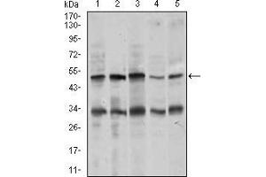 Western blot analysis using CHGA mouse mAb against MOLT4 (1), SK-N-SH (2), HepG2 (3), PC-12 (4), and C6 (5) cell lysate. (Chromogranin A Antikörper  (AA 87-252))