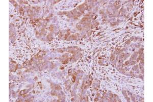 Immunohistochemistry (IHC) image for anti-Optineurin (OPTN) antibody (ABIN2856108)