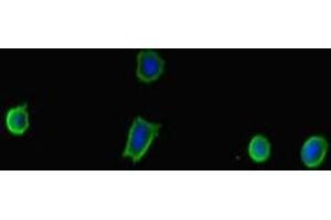 Immunofluorescent analysis of MCF-7 cells using ABIN7173921 at dilution of 1:100 and Alexa Fluor 488-congugated AffiniPure Goat Anti-Rabbit IgG(H+L) (TP53INP2 Antikörper  (AA 100-220))
