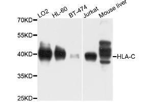 Western blot analysis of extracts of various cell lines, using HLA-C antibody (ABIN4903930) at 1:1000 dilution. (HLA-C Antikörper)