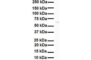 WB Suggested Anti-SNRP70 antibody Titration: 1 ug/mL Sample Type: HEK293 (SNRNP70 Antikörper  (N-Term))