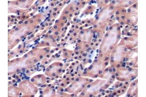DAB staining on IHC-P; Samples: Mouse Kidney Tissue (LY9 Antikörper  (AA 384-642))