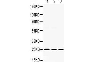 Western blot analysis of Smac/Diablo expression in rat testis extract (lane 1), 22RV1 whole cell lysates (lane 2) and SKOV whole cell lysates (lane 3). (DIABLO Antikörper  (AA 56-239))