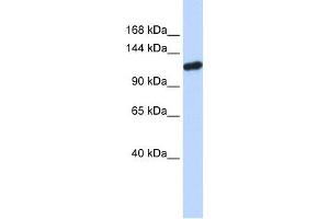 PIWIL4 antibody used at 1 ug/ml to detect target protein. (PIWIL4 Antikörper)