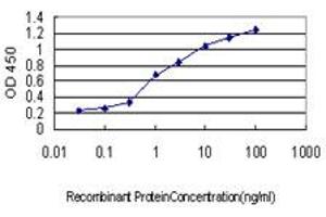 Detection limit for recombinant GST tagged CRX is approximately 0. (CRX Antikörper  (AA 1-95))