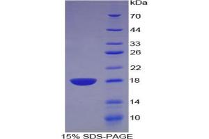 SDS-PAGE analysis of Rat Artemin Protein. (ARTN Protein)