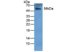 Detection of FGB in Human Liver Tissue using Polyclonal Antibody to Fibrinogen Beta Chain (FGB)