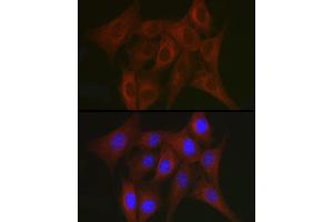 Immunofluorescence analysis of NIH/3T3 cells using TR antibody (ABIN3023477, ABIN3023478, ABIN3023479 and ABIN6220053) at dilution of 1:50. (TRAF7 Antikörper)