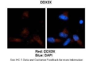 Sample Type :  Human brain stem cells (NT2)   Primary Antibody Dilution :   1:500  Secondary Antibody :  Goat anti-rabbit Alexa Fluor 594  Secondary Antibody Dilution :   1:1000  Color/Signal Descriptions :  Red: DDX3X Blue: DAPI  Gene Name :  DDX3X  Submitted by :  Dr. (DDX3X Antikörper  (N-Term))