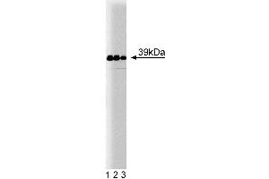Western blot analysis of Jun on human endothelial cell lysate. (C-JUN Antikörper  (AA 26-175))