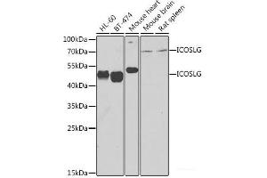 Western blot analysis of extracts of various cell lines using ICOSL Polyclonal Antibody at dilution of 1:1000. (ICOSLG Antikörper)