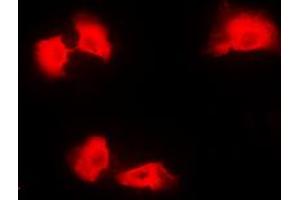 Immunofluorescent analysis of Kanadaptin staining in A431 cells. (NADAP Antikörper  (Center))