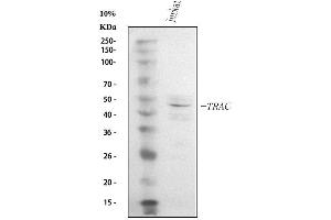 Western blot analysis of TCR alpha/TRAC using anti-TCR alpha/TRAC antibody (ABIN6719654). (TRAC Antikörper  (AA 1-114))