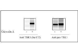 HeLa cells were treated or untreated with Calyculin A. (TBK1 ELISA Kit)