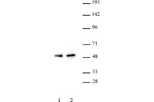 PAX5 antibody (pAb) tested by Western blot. (PAX5 Antikörper  (N-Term))