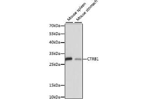Western blot analysis of extracts of various cell lines, using CTRB1 antibody (ABIN7266398) at 1:1000 dilution. (CTRB1 Antikörper  (AA 79-263))