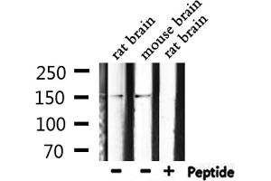 Western blot analysis of extracts from rat brain, mouse brain, using Phospho-PLCG1 (Tyr771) Antibody.