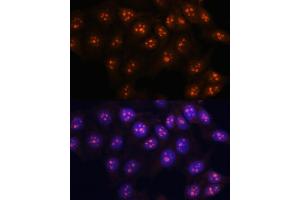 Immunofluorescence analysis of HeLa cells using Fibrillarin/U3 RNP antibody (ABIN6130429, ABIN6140494, ABIN6140496 and ABIN6217509) at dilution of 1:100. (Fibrillarin Antikörper  (AA 100-321))