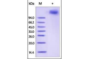 Human VCAM-1, His Tag on SDS-PAGE under reducing (R) condition. (VCAM1 Protein (AA 25-697) (His tag))