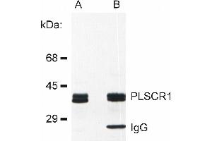 PLSCR1 Antikörper