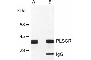Detection of PLSCR1 in rat basophilic leukemia (RBL) cell line lysate (A) and in PLSCR1 immunoprecipitate from RBL lysate (B). (PLSCR1 Antikörper)