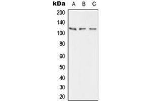 Western blot analysis of PMCA2 expression in HEK293T (A), mouse brain (B), rat brain (C) whole cell lysates. (ATP2B2 Antikörper  (Center))