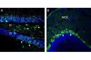 Expression of OXGR1/GPR99 in mouse hippocampus and cerebellum - Immunohistochemical staining of perfusion-fixed frozen mouse brain sections with Anti-OXGR1/GPR99 Antibody (ABIN7043418, ABIN7044895 and ABIN7044896), (1: 200), followed by goat anti-rabbit-AlexaFluor-488. (OXGR1 Antikörper  (C-Term, Intracellular))