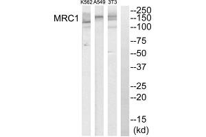 Western blot analysis of extracts from K562 cells, A549 cells and NIH-3T3 cells, using MRC1 antibody. (Macrophage Mannose Receptor 1 Antikörper  (Internal Region))