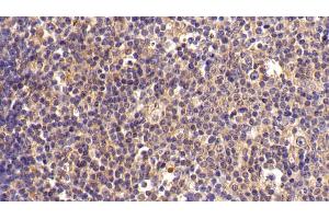 Immunohistochemistry (IHC) image for anti-FK506 Binding Protein 7 (FKBP7) (AA 24-217) antibody (ABIN7443236)