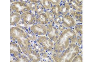 Immunohistochemistry of paraffin-embedded Mouse kidney using NLRC4 Polyclonal Antibody at dilution of 1:100 (40x lens). (NLRC4 Antikörper)