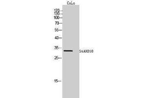 Western Blotting (WB) image for anti-StAR-Related Lipid Transfer (START) Domain Containing 10 (STARD10) (Internal Region) antibody (ABIN3187075)